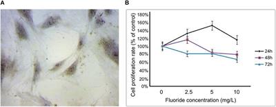 Expression of Autophagy-Related Factors LC3A and Beclin 1 and Apoptosis-Related Factors Bcl-2 and BAX in Osteoblasts Treated With Sodium Fluoride